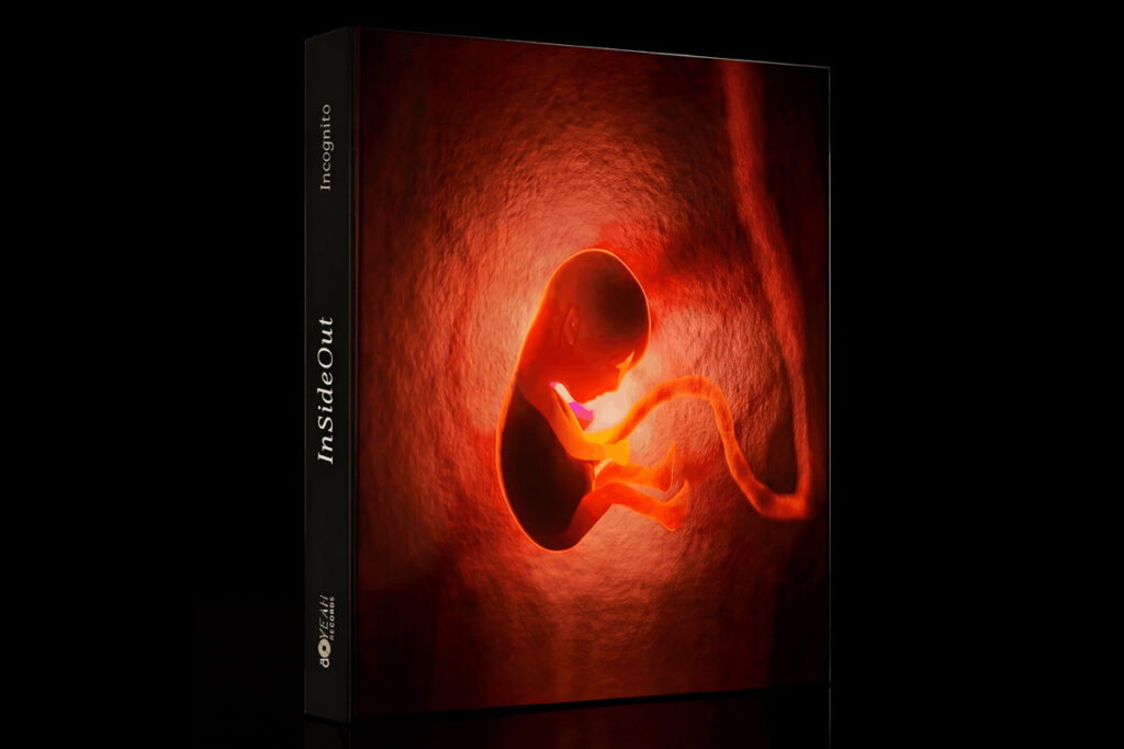 vinyl-vision-3000-03